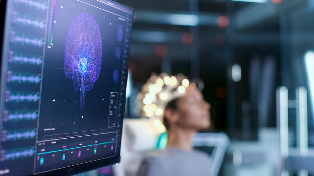 /unimagdeburg_media/Presse/Bilder/Pressemitteilungen/2026/Gehirn_Scan+fu%CC%88r+neurowissenschaftliche+Forschung+%28c%29+Shutterstock-height-560-width-1000-p-138413.jpg